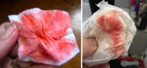 Кровянистые выделения после спринцевании. Такое бывает?