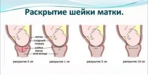 Зрелая шейка матки в 38 недель а сейчас 41