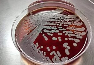 Staphylococcus aureus в бак посеве