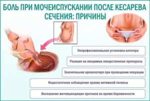 Боль в конце мочеиспускания после операции