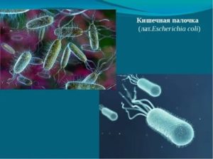 Кишечная палочка Escherichia coli 10^7 в посеве спермы