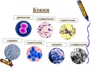 Кокки в мазке у девочки 2 года