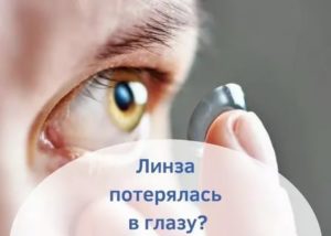 Что делать если линза потерялась в глазу