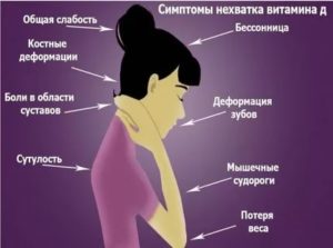 Недостаток витамина Д к кому обратиться