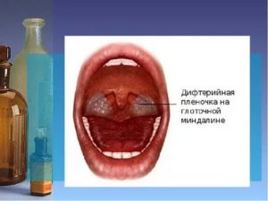 В горле пленка