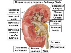 Признаки расщепления почечного синуса справа