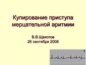 Купирование приступа мерцательной аритмии