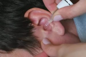Дексаметозол при свисте в ухе
