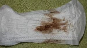 Кровянистые выделения 3 недели