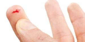 Ранка на руке, не гноится но постоянно кровоточит