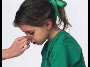 Назонекс и кровотечение из носа