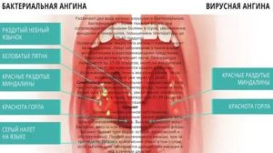 Горло не болит, но есть температура