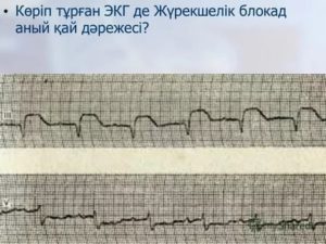 Блокада пучка Бахмана