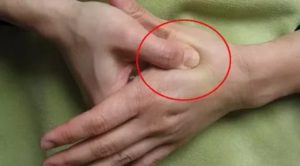 Косточка между указательным и средним пальцем на руке
