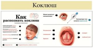 Повторная высокая температура при коклюше