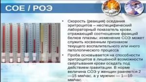 Высокое СОЭ и температура после операции