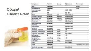 В анализе мочи лейкоциты повышены 25-30