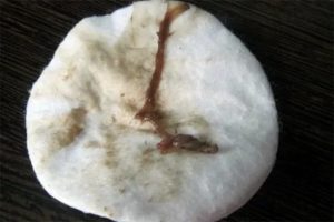 Коричневые выделения у девственницы