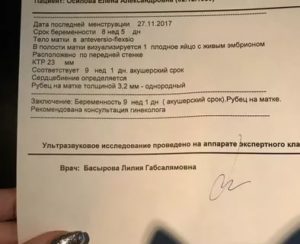 Срок по УЗИ меньше чем по месячным