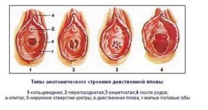 Можно ли потерять девственицу под струей воды?