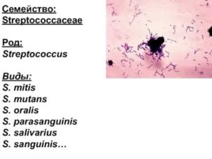 Посев из эякулята streptococcus mitis и streptococcus mitis