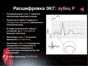 ЭКГ сердца расшифровка