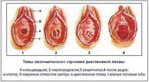 Больно заниматься сексом после лишения девственности