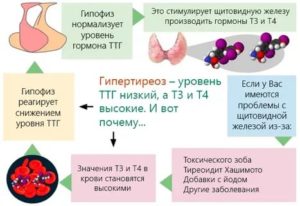 Узел в щетовидной железе и низкий ттг