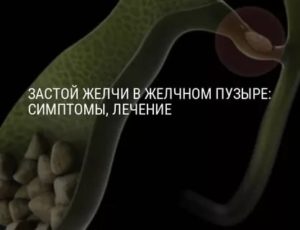 Застой желчи