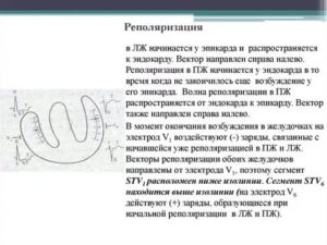 ЭКГ. Нарушение процессов реполяризации в миокарде ЛЖ