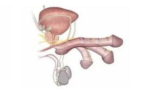 Нестабильность в эрекции и глубокое проникновение