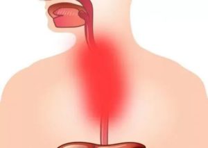 Боль и сильное жжение в пищеводе и желудке. Что делать?