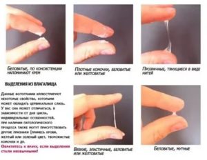 Выделения после отмены Фемилекса