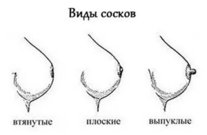 Неправильная форма сосков