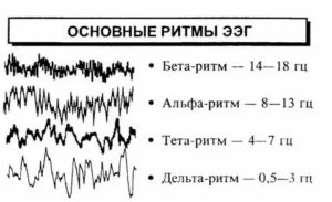 Что означает изменение корковой ритмики в результатах ЭЭГ