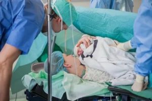 Кесарево 30 недель беременности