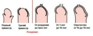 Как определить полностью ли открыта головка члена?