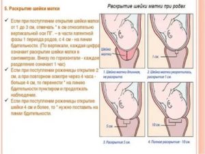 Короткая шейка 1,3см