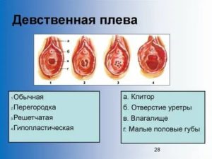 Половой акт был, но врач сказал, что я девственница