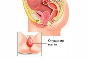 Непонятные ощущения во влагалище при беременности