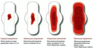 Мало крови при месячных почему так