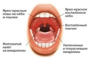 Красное небо у ребенка