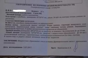 Какие я должна сдать анализы при кисте левого яичника