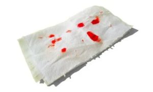 После стула на туалетной бумаге заметила капли крови