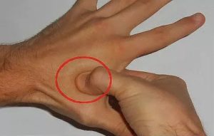 Ямка между большим и указательным пальльцем левой кисти руки