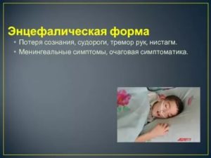Судороги или тремор после сна у ребенка