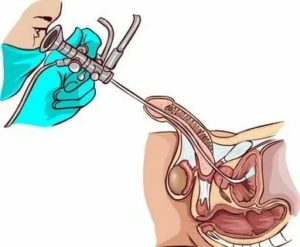 Пропала сперма после осмотра простаты