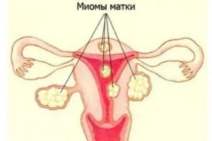 Месячные в 57 лет