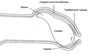 Короткая уздечка на члене, и 2 спайки если не ошибаюсь хинесии