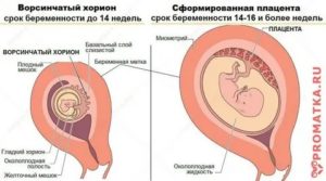 Замершая беременность, нарушение развития ворсин хориона